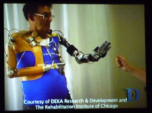 DEKA Research Luke arm протез